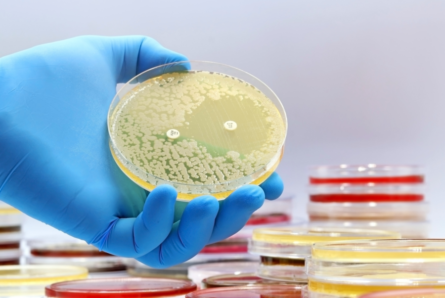 Antimicrobial resistance jeopardizes food safety, sustainable production and the “From Farm to Fork” strategy Antimicrobial resistance jeopardizes food safety, sustainable production and the “From Farm to Fork” strategy