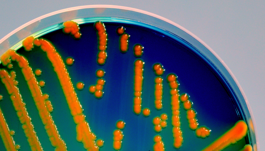 Escherichia coli can cause intestinal and extraintestinal infections in humans and animals Escherichia coli can cause intestinal and extraintestinal infections in humans and animals