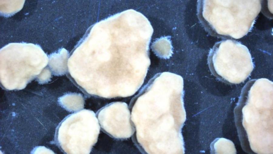 Detalle de gránulos aerobios de reactores tratando auga dunha industria conserveira Detalle de gránulos aerobios de reactores tratando auga dunha industria conserveira