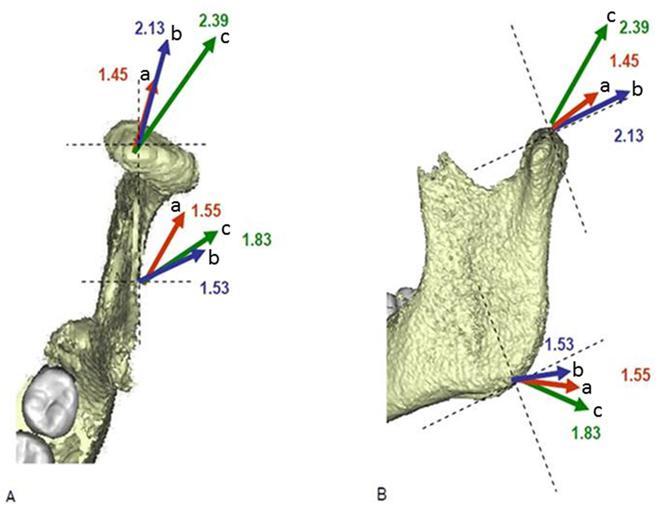 Un estudo multidisciplinar desenvolve un novo método para valorar a artrite na articulación da mandíbula