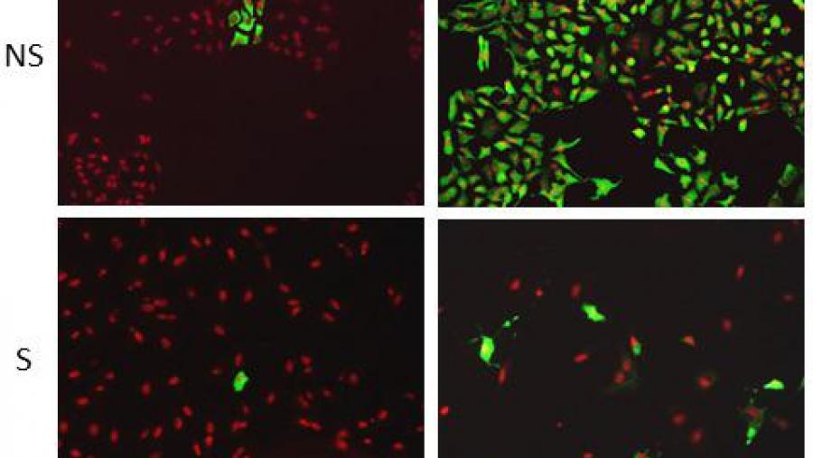 Células non senescentes (NS) mostran un maior grao de infección inicial (virus en verde) que progresa de forma eficiente a todas as células tras 24 horas (en vermello). As células senescentes (S)...