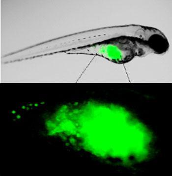 Un equipo da USC identifica un novo mecanismo no desenvolvemento de metástases asociadas ao cancro de mama