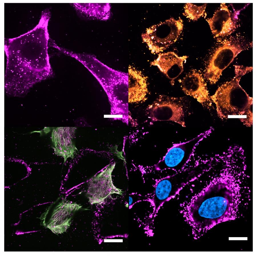 O novo vehículo fusiónase coa membrana da célula anfitrioa para liberar moléculas bioactivas no seu interior
