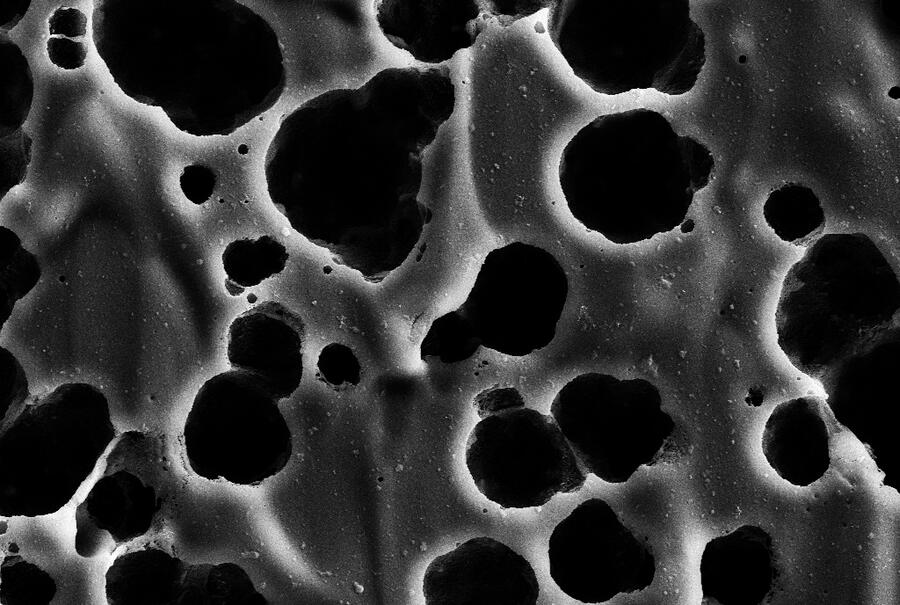 Imaxe de microscopia electrónica de barrido na que se mostra a superficie dunha lámina de PET sendo degradada polo encima immobilizado en nanoesferas proteicas