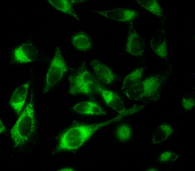 Deseñan catalizadores metálicos que funcionan na mitocondria celular