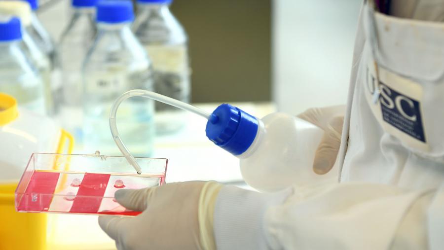 Este traballo foi publicado na revista 'Hepatology'. FOTO: Santi Alvite