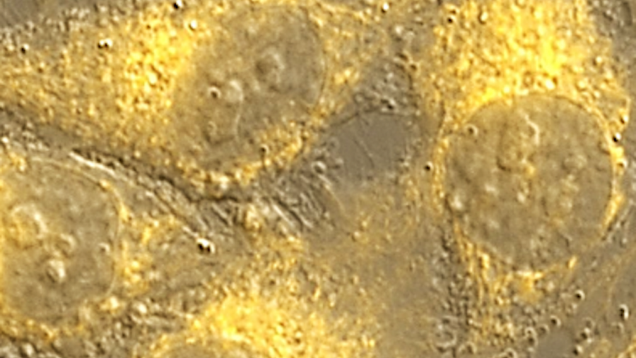 Este traballo logrou dar resposta ao desafío que supón controlar transformacións químicas no medio celular