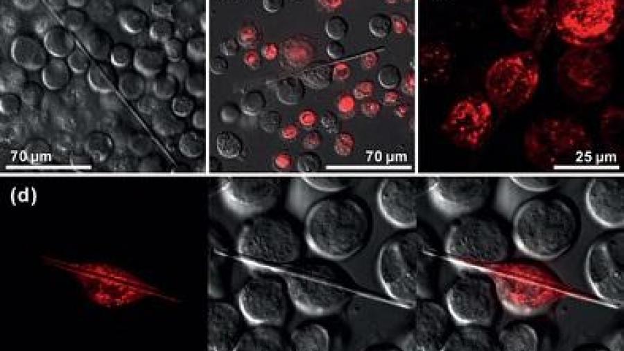 Figura: Morfoloxía e localización intracelular in vivo de cristais de luciferasa de vagalume