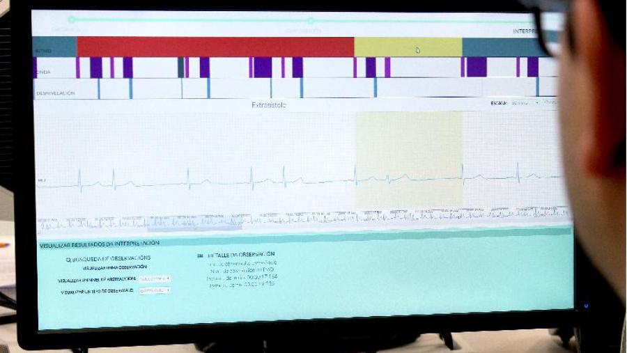 Nace nos laboratorios do CiTIUS da USC o sistema automático máis preciso do mundo para interpretar o electrocardiograma