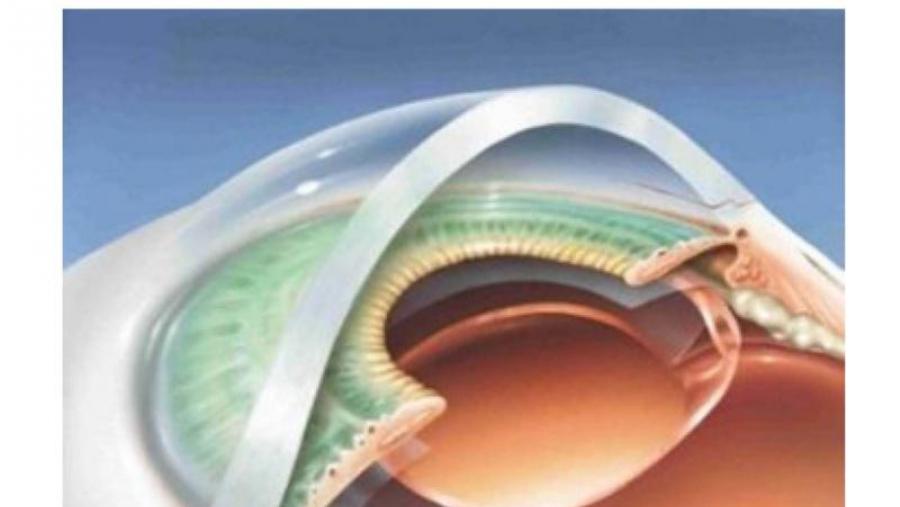 O proxecto Nanoeaters presentará no CiTIUS o sensor Eyepress para a medida da presión intraocular